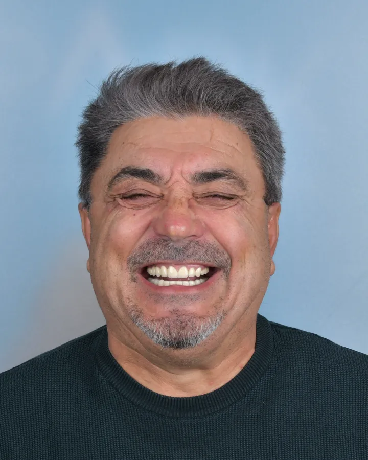 După tratamentul implantar